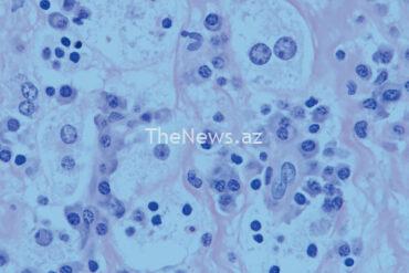 iarc-marks-world-hepatitis-day-2024